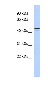 ENPP6 antibody LS-C102528 Western blot of 721_B cell lysate.