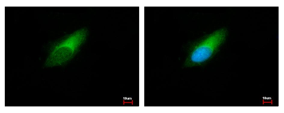 ENSA antibody detects ENSA protein at cytoplasm by immunofluorescent analysis. HeLa cells were fixed in ice-cold Methanol for 5 min. ENSA protein stained by ENSA antibody diluted at 1:500.
