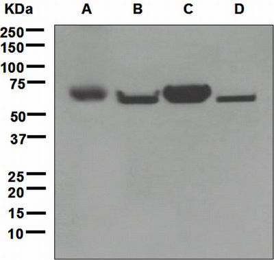 Western blot analysis on (A) human placenta, (B) JAR, (C) fetal kidney, and (D) U87-MG cell lysates using anti-ENTPD2 (CD39L1) antibody.