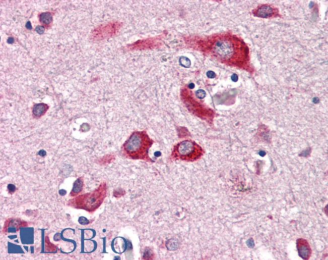 Anti-ENTPD2 antibody LS-A9775 IHC of human brain, cortex. Immunohistochemistry of formalin-fixed, paraffin-embedded tissue after heat-induced antigen retrieval.