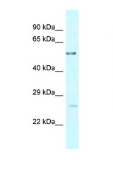 ENTPD3 antibody LS-C145825 Western blot of Fetal Lung lysate. Antibody concentration 1 ug/ml.