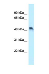 ENTPD5 antibody LS-C145881 Western blot of HT1080 Cell lysate. Antibody concentration 1 ug/ml.