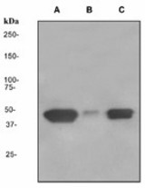Western blot analysis on (A) Fetal liver lysates (B) Hela and (C) LNCaP lysates using anti-ENTPD5 antibody (LS-C105643).
