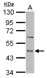 Sample (50 ug of whole cell lysate) A: mouse liver 10% SDS PAGE ENTPD5 antibody diluted at 1:10000