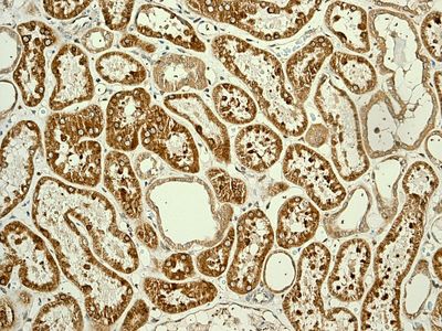 IHC of paraffin-embedded human kidney tissue using anti-ENTPD5 antibody.
