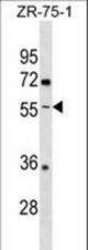 ENTPD5 Antibody western blot of ZR-75-1 cell line lysates (35 ug/lane). The ENTPD5 antibody detected the ENTPD5 protein (arrow).