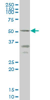 ENTPD5 monoclonal antibody (M07), clone 4A5 Western Blot analysis of ENTPD5 expression in HepG2.