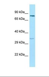Western blot of Human Hela. ENTPD6 antibody dilution 1.0 ug/ml.