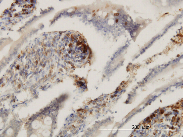 Immunoperoxidase of monoclonal antibody to ENTPD6 on formalin-fixed paraffin-embedded human small Intestine. [antibody concentration 3 ug/ml]