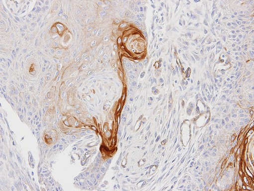 IHC of paraffin-embedded Ca922 xenograft using ENTPD6 antibody at 1:100 dilution.