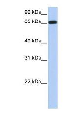 Fetal brain lysate. Antibody concentration: 1.0 ug/ml. Gel concentration: 12%.