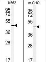 (LEFT)Western blot of ENTPD8 Antibody in K562 cell line lysates (35 ug/lane). ENTPD8 (arrow) was detected using the purified antibody. (RIGHT)Western blot of ENTPD8 Antibody in CHO cell line lysates (35 ug/lane). ENTPD8 (arrow) was detected using the purified antibody.