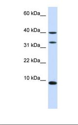 Fetal liver lysate. Antibody concentration: 1.0 ug/ml. Gel concentration: 10-20%.
