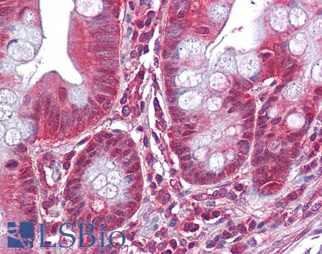 Anti-DBI antibody IHC of human small intestine. Immunohistochemistry of formalin-fixed, paraffin-embedded tissue after heat-induced antigen retrieval. Antibody LS-B6257 dilution 1:200.