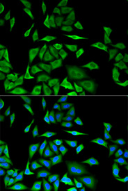 Immunofluorescence analysis of MCF-7 cell using DBI antibody. Blue: DAPI for nuclear staining.