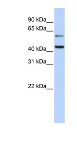 CMAS antibody LS-C102322 Western blot of Fetal Brain lysate.