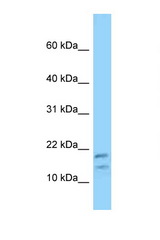 DBI antibody LS-C146261 Western blot of HT1080 Cell lysate. Antibody concentration 1 ug/ml.