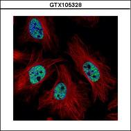 Confocal immunofluorescence analysis (Olympus FV10i) of paraformaldehyde-fixed HeLa using CMAS antibody (Green) at 1:500 dilution. Alpha-tubulin filaments were labeled with alpha-tubulin antibody (Red) at 1:2000.