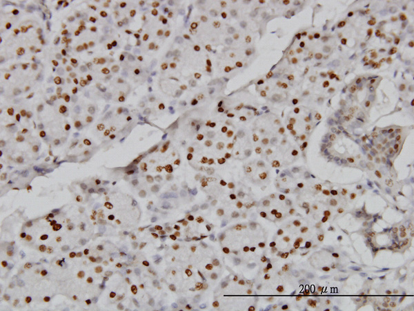 Immunoperoxidase of monoclonal antibody to CMAS on formalin-fixed paraffin-embedded human salivary gland (antibody concentration 3 ug/ml).