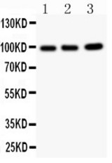 EPB41L1 antibody Western blot. All lanes: Anti EPB41L1 at 0.5 ug/ml. Lane 1: Rat Brain Tissue Lysate at 50 ug. Lane 2: Mouse Brain Tissue Lysate at 50 ug. Lane 3: A549 Whole Cell Lysate at 40 ug. Predicted band size: 98 kD. Observed band size: 98 kD.