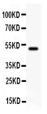 EPB41L1 antibody Western blot. All lanes: Anti EPB41L1 at 0.5 ug/ml. WB: Recombinant Human EPB41L1 Protein 0.5ng. Predicted band size: 50 kD. Observed band size: 50 kD.