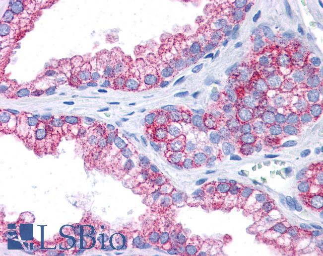 Anti-EPB41L2 antibody IHC of human prostate. Immunohistochemistry of formalin-fixed, paraffin-embedded tissue after heat-induced antigen retrieval. Antibody LS-B4681 concentration 5 ug/ml.