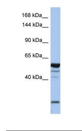 MCF7 cell lysate. Antibody concentration: 1.0 ug/ml. Gel concentration: 6-18%.