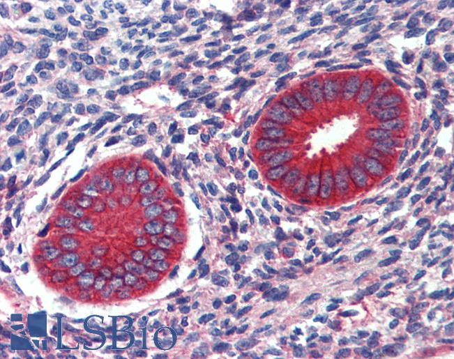 Anti-EPB41L2 antibody IHC of human uterus. Immunohistochemistry of formalin-fixed, paraffin-embedded tissue after heat-induced antigen retrieval. Antibody LS-B3962 concentration 2.5 ug/ml.