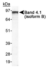 Detection of Band 4.1 in HeLa whole cell lysate.