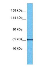 Western blot of E41L3 Antibody with human Fetal Lung lysate.