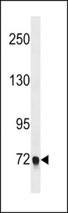 EPB41L5 Antibody western blot of A549 cell line lysates (35 ug/lane). The EPB41L5 antibody detected the EPB41L5 protein (arrow).