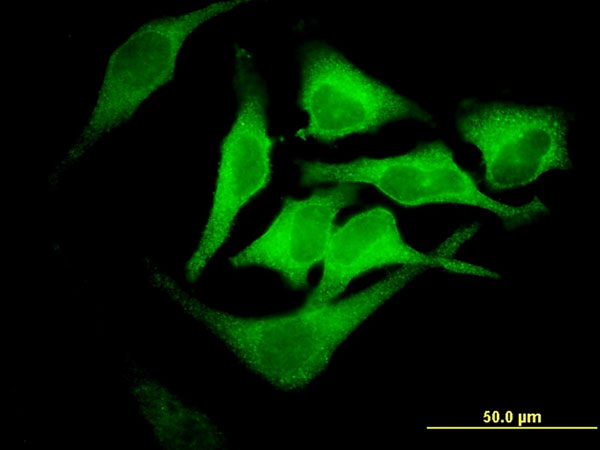 Immunofluorescence of monoclonal antibody to EPB42 on HeLa cell . [antibody concentration 10 ug/ml]