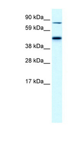 EPB42 / Pallidin antibody LS-B1526 Western blot of Fetal liver lysate.