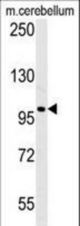 Western blot of EPC2 Antibody in mouse cerebellum tissue lysates (35 ug/lane). EPC2 (arrow) was detected using the purified antibody.