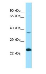 EPDR / EPDR1 antibody Western Blot of Jurkat. Antibody dilution: 1 ug/ml.