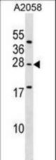EPDR1 Antibody western blot of A2058 cell line lysates (35 ug/lane). The EPDR1 antibody detected the EPDR1 protein (arrow).