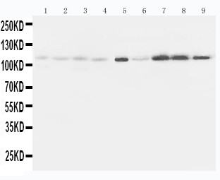 WB of EPHA1 / EPH Receptor A1 antibody. All lanes: Anti-EPHA1 at 0.5ug/ml. Lane 1: Rat Liver Tissue Lysate at 40ug. Lane 2: Rat Lung Tissue Lysate at 40ug. Lane 3: Rat Intestine Tissue Lysate at 40ug. Lane 4: Rat Ovary Tissue Lysate at 40ug. Lane 5: U87 Whole Cell Lysate at 40ug. Lane 6: A549 Whole Cell Lysate at 40ug. Lane 7: COLO320 Whole Cell Lysate at 40ug. Lane 8: SW620 Whole Cell Lysate at 40ug. Lane 9: HELA Whole Cell Lysate at 40ug. Predicted bind size: 108KD. Observed bind size: 108KD.