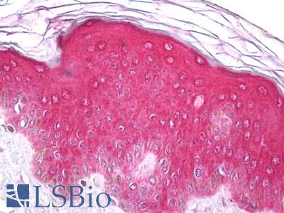 Anti-EPHA1 antibody IHC of human skin, epidermis. Immunohistochemistry of formalin-fixed, paraffin-embedded tissue after heat-induced antigen retrieval. Antibody LS-B7782 dilution 10 ug/ml.