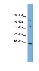 C16orf61 antibody LS-C112043 Western blot of Fetal Kidney lysate.