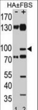 Western blot of EphA2 Antibody (pS897) antibody (RB21717) pre-incubated without(lane 1) and with(lane 2) FBS in HA cell line lysate. EphA2 Antibody (pS897) (arrow) was detected using the purified antibody(Kindly provided by Dr. John Wu).