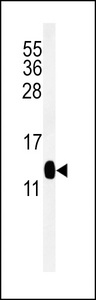 Western blot of DC13 Antibody in mouse kidney tissue lysates (35 ug/lane). DC13 (arrow) was detected using the purified antibody.