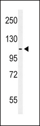 Western blot of hEPHA2-T45 in MCF-7 cell line lysates (35 ug/lane). EPHA2 (arrow) was detected using the purified Pab