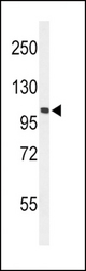 Western blot of hEPHA2-T45 in mouse NIH-3T3 cell line lysates (35 ug/lane). EPHA2 (arrow) was detected using the purified antibody.