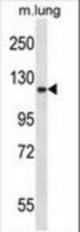 Mouse Epha2 Antibody western blot of mouse lung tissue lysates (35 ug/lane). The Epha2 antibody detected the Epha2 protein (arrow).