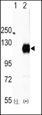Western blot of EphA2 (arrow) using rabbit polyclonal EphA2 Antibody. 293 cell lysates (2 ug/lane) either nontransfected (Lane 1) or transiently transfected with the EphA2 gene (Lane 2) (Origene Technologies).