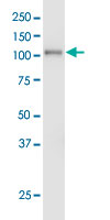 EPHA3 monoclonal antibody (M01), clone 3A12. Western Blot analysis of EPHA3 expression in human spleen.