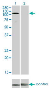Western blot analysis of EPHA3 over-expressed 293 cell line, cotransfected with EPHA3 Validated Chimera RNAi (Lane 2) or non-transfected control (Lane 1). Blot probed with EPHA3 monoclonal antibody (M01) clone 3A12 . GAPDH ( 36.1 kDa ) used as specificity and loading control.