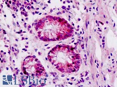 Anti-EPHA3 / EPH Receptor A3 antibody IHC staining of human small intestine. Immunohistochemistry of formalin-fixed, paraffin-embedded tissue after heat-induced antigen retrieval.