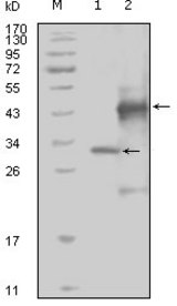 Western blot using EphA4 mouse monoclonal antibody against truncated Trx-EphA4 recombinant protein (1) and truncated GST-EphA4(aa777-986) recombinant protein (2).
