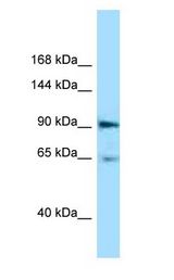 EPHA4 antibody Western Blot of Mouse Pancreas.